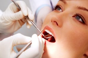 dental fillings